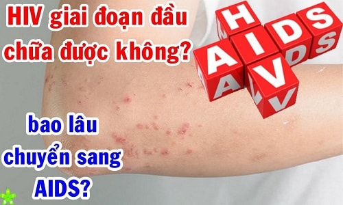 Hiv giai đoạn đầu có chữa được không