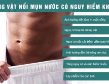 DƯƠNG VẬT NỔI MỤN NƯỚC CÓ NGUY HIỂM KHÔNG?
