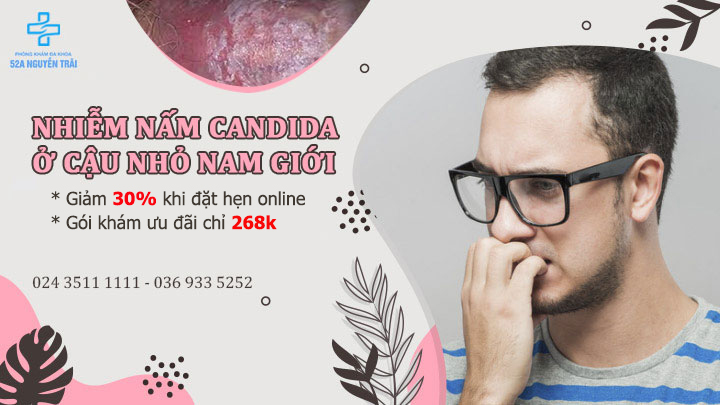 90% Nam giới không biết nấm Candida dương vật là bệnh gì?