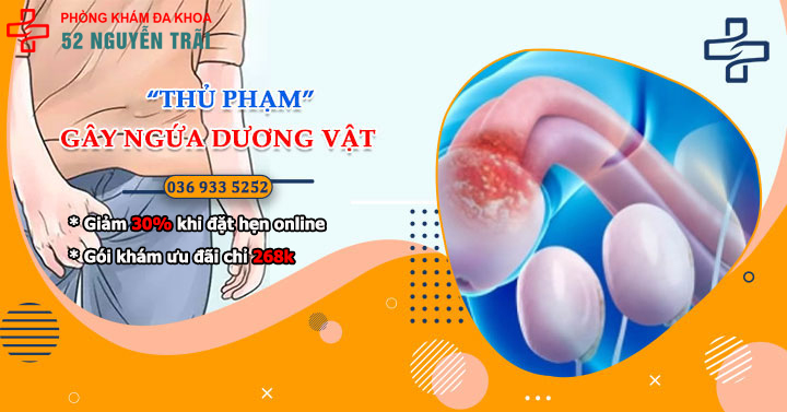 Chia sẻ “THỦ PHẠM” gây ngứa dương vật & Đâu là cách khắc phục hiệu quả?