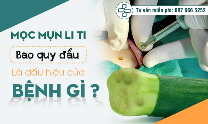 Mụn li ti ở bao quy đầu là dấu hiệu của bệnh gì